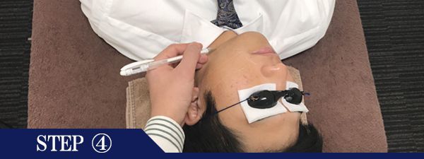 あご裏ヒゲ脱毛Step4