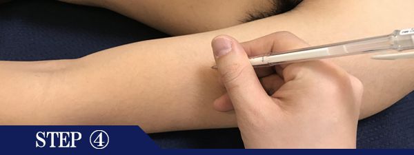 ひじ上脱毛Step4