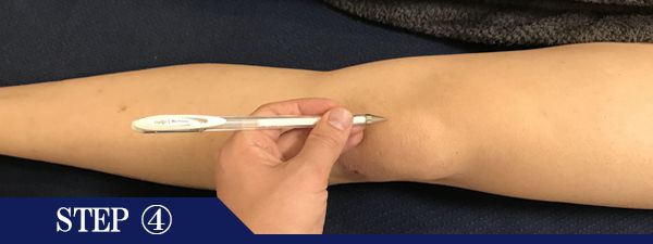 ひざ頭脱毛Step4