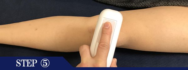 ひざ頭脱毛Step5