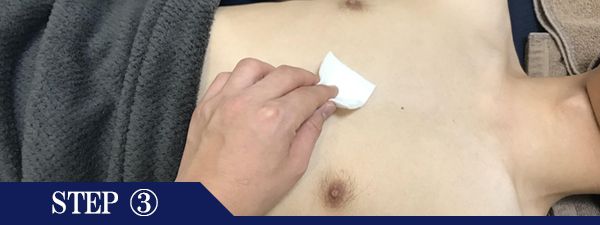 胸元脱毛Step3
