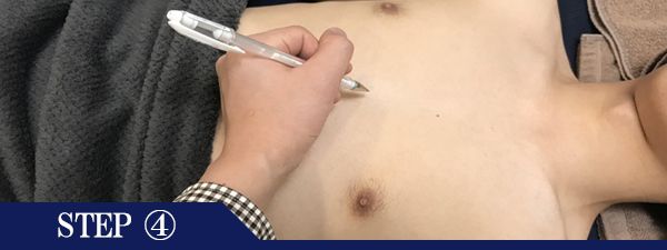 胸元脱毛Step4