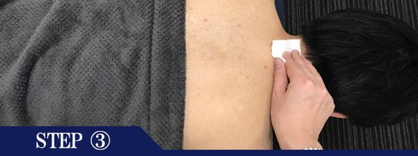 うなじ脱毛Step3