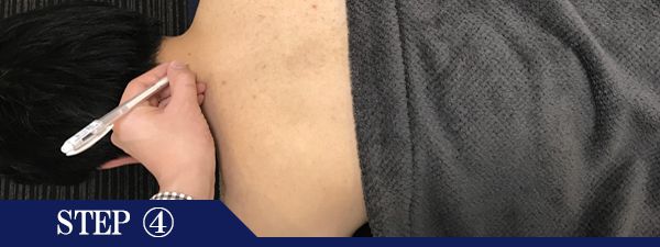 うなじ脱毛Step4